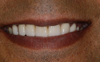 After - Staplehurstdentalpractice