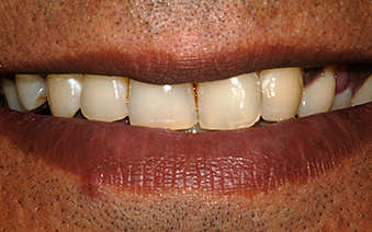 Before - Staplehurstdentalpractice