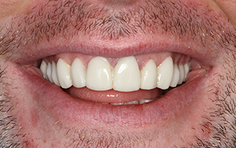 After - Staplehurstdentalpractice