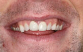 Before - Staplehurstdentalpractice