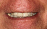 Before - Staplehurstdentalpractice
